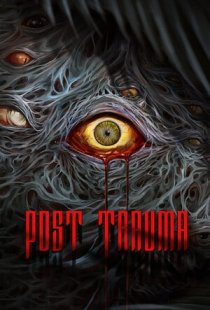 Post Trauma